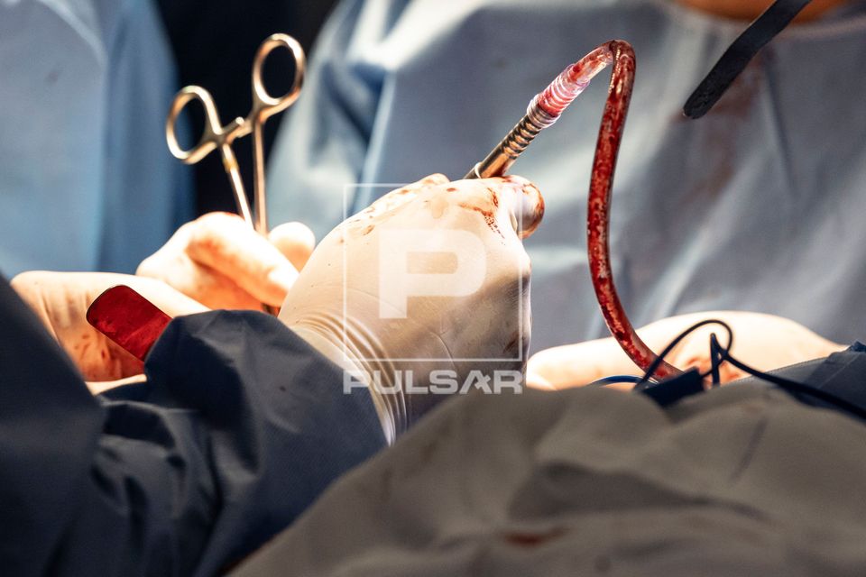 Cirurgia bucomaxilofacial