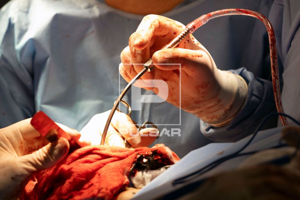 Cirurgia bucomaxilofacial