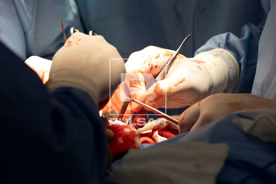 Cirurgia bucomaxilofacial
