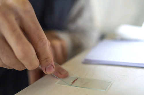 Parasitologista coletando amostra de sangue de espécie coletada na Serra do Imeri - Parque Nacional do Pico d