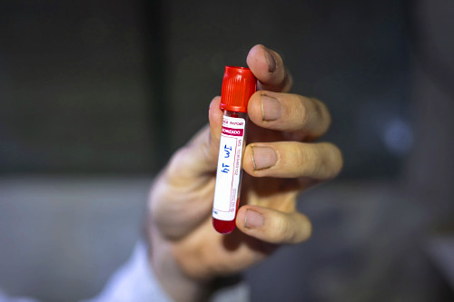 Parasitologista com amostra de sangue coletada de espécie coletada na Serra do Imeri - Parque Nacional do Pic